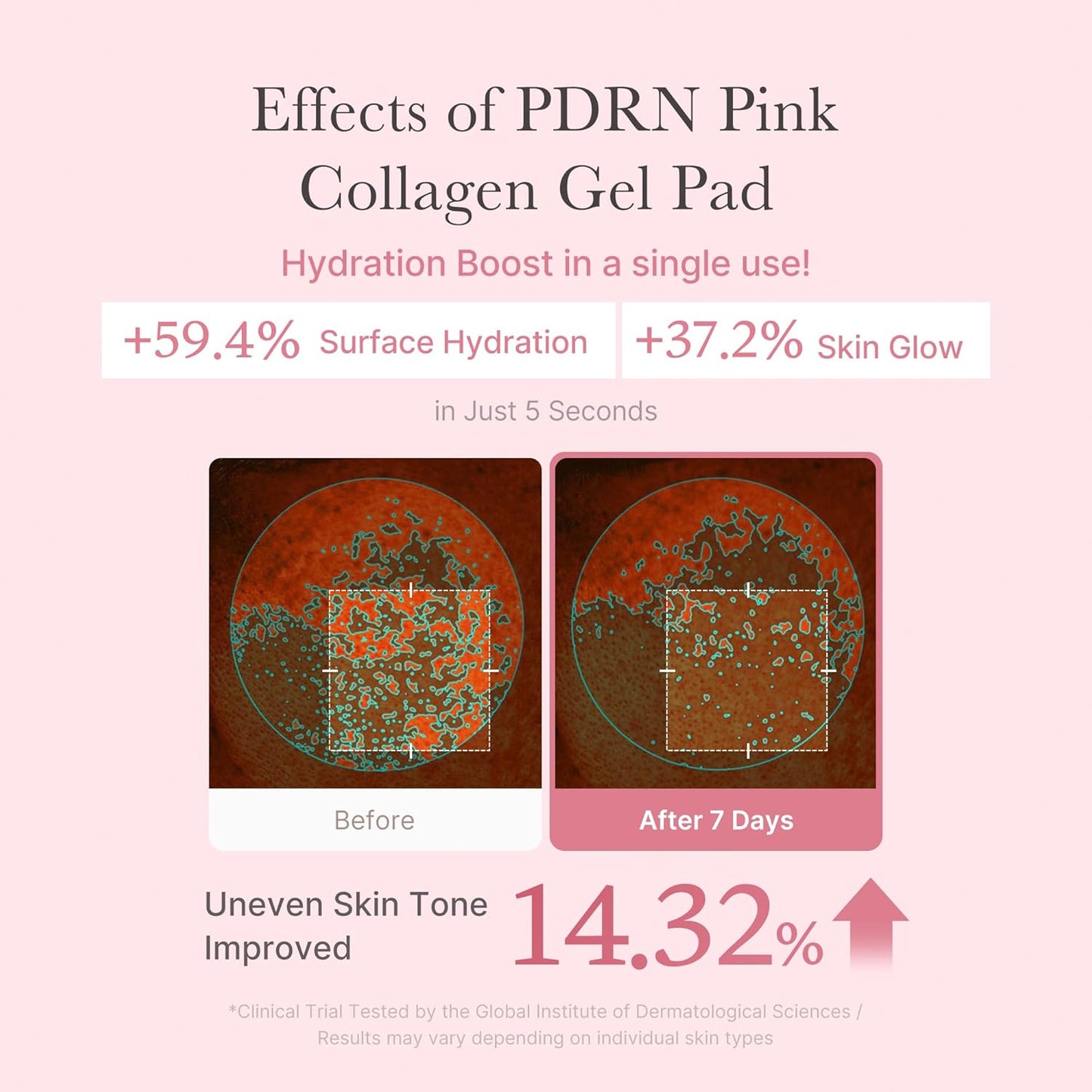 Medicube PDRN Pink Collagen Toning Gel Pads 120 ml